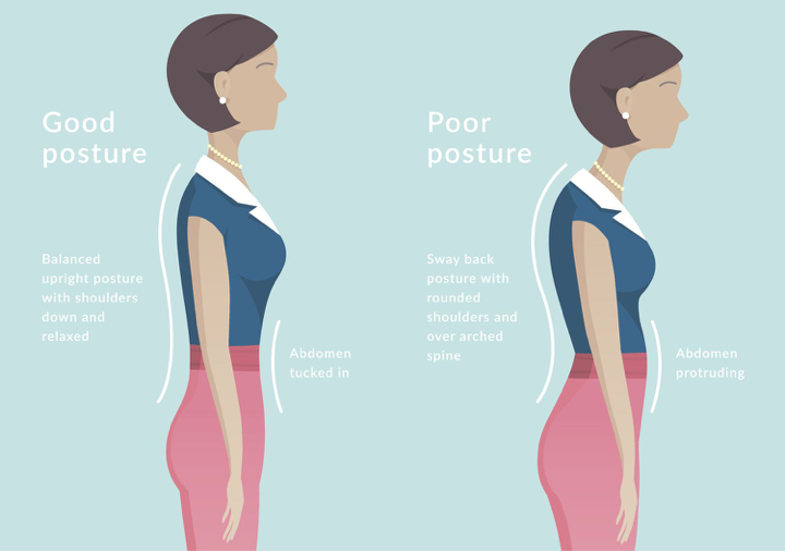 Posture GERD